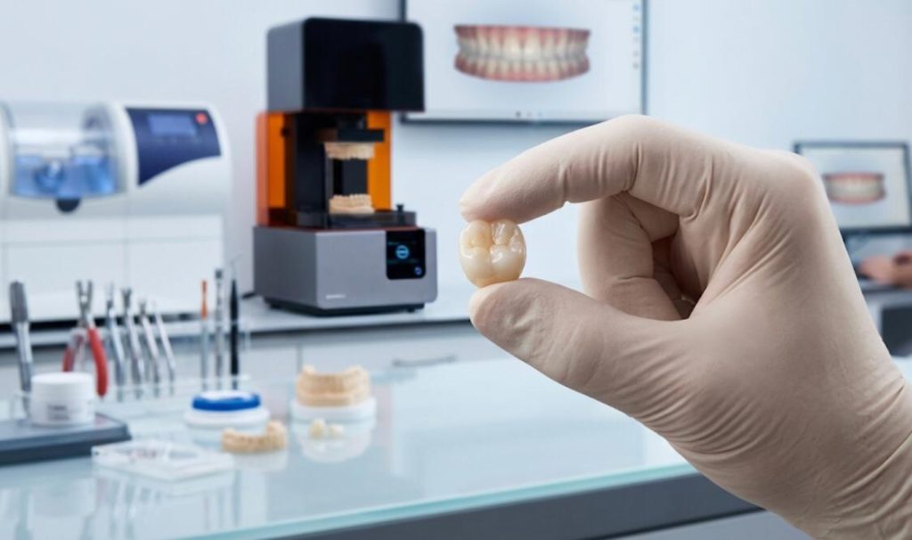 Gloved hand holding a single custom-made dental crown molar restoration within a modern Abraham Dental Art laboratory environment in Wesley Chapel, Florida.
